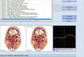 2014 Original Russian 8d Nls Health Analyzer Full Body Test