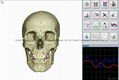 Metatron Hunter NLS System  4025  Bioresonance Health Scan and Therapy