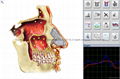 Metatron Hunter NLS System  4025  Bioresonance Health Scan and Therapy