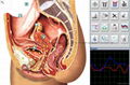 Metatron Hunter NLS System  4025  Bioresonance Health Scan and Therapy