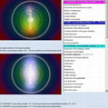 	2014 Bioresonance Scanner 8d lris nls IRIS- nls Quantum Health Analyzer Machine