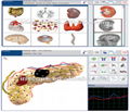 FREE Shipping Metatron Hunter NLS System Dolma 4025 * Bioresonance Health Scan