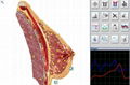 Sub Health Metatron Nls 4025 Analyzer Multi-function for Blood Analyzer