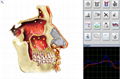 Metatron Hunter 4025 NLS System Bioresonance Health Scan and Therapy