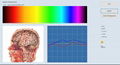 2019年SSCH生物反馈健康分析仪矢量V16 NLS光环脉轮机