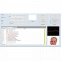 vector v16 nls bioresonance health diagnosis analyzer faster and stable 