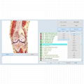 8D NLS biofeedback for healing body analysis device Vector V16 NLS 