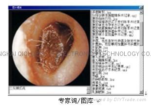 Endoscope digital image workstation 3