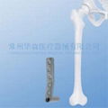 Dynamic Condylar Screw Plate (DCS)--Bone Fracture, Pure titanium, Trauma 2
