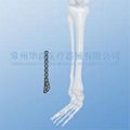 Distal Lateral Fibular LOC Plate--Orthopedic implants, Pure titanium, LOC 3