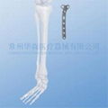 T-buttress Plate--Bone Fracture, Orthopedic implants, Pure titanium, Trauma 2