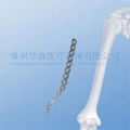 Distal Lateral Humeral Plate--Fracture, Orthopedic implants, Trauma, LCP, Placa 2