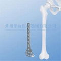 Distal Lateral Femoral (Condylar) Plate II--Orthopedic implants, Pure titanium 2