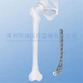 Distal Medial Femoral (Condylar) Plate--Orthopedic implants, Trauma, LCP, Placa 2