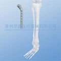 Proximal Lateral Tibial Golf Plate--Fracture, Pure titanium, Trauma, LCP, Placa 2