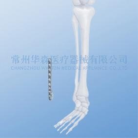 腓骨远端外侧接骨板--骨科植入物、纯钛、创伤、LCP 2