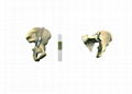 DS 蝶形骶髂骨鎖定接骨板--骨科植入物、純鈦、LOC、創傷 3