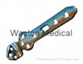 Ankle Locking Plate--LOC, Implants, Foot orthoses, Joints, Orthopaedics