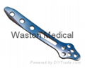 Ankle Locking Plate--LOC, Implants, Foot orthoses, Joints, Orthopaedics