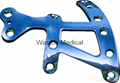 Ankle Locking Plate--LOC, Implants, Foot orthoses, Joints, Orthopaedics 11