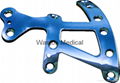 Ankle Locking Plate--LOC, Implants, Foot orthoses, Joints, Orthopaedics