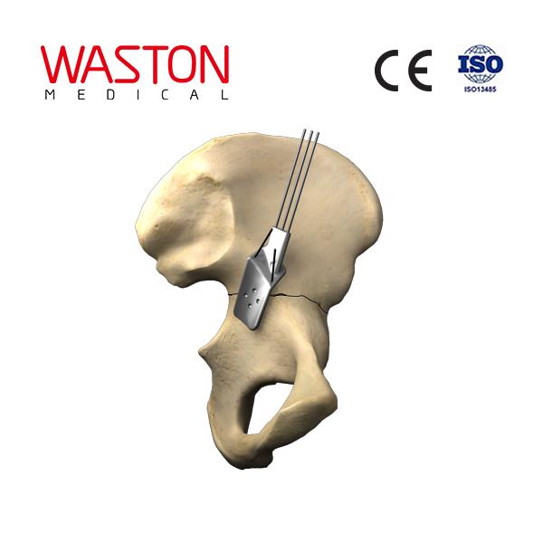 YAP-Master Guidance System--Orthopedic implants, Trauma, Pelvic reconstruction