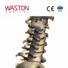 NEULEN 颈椎椎板成型系统--骨科植入物、微创、脊柱、矫