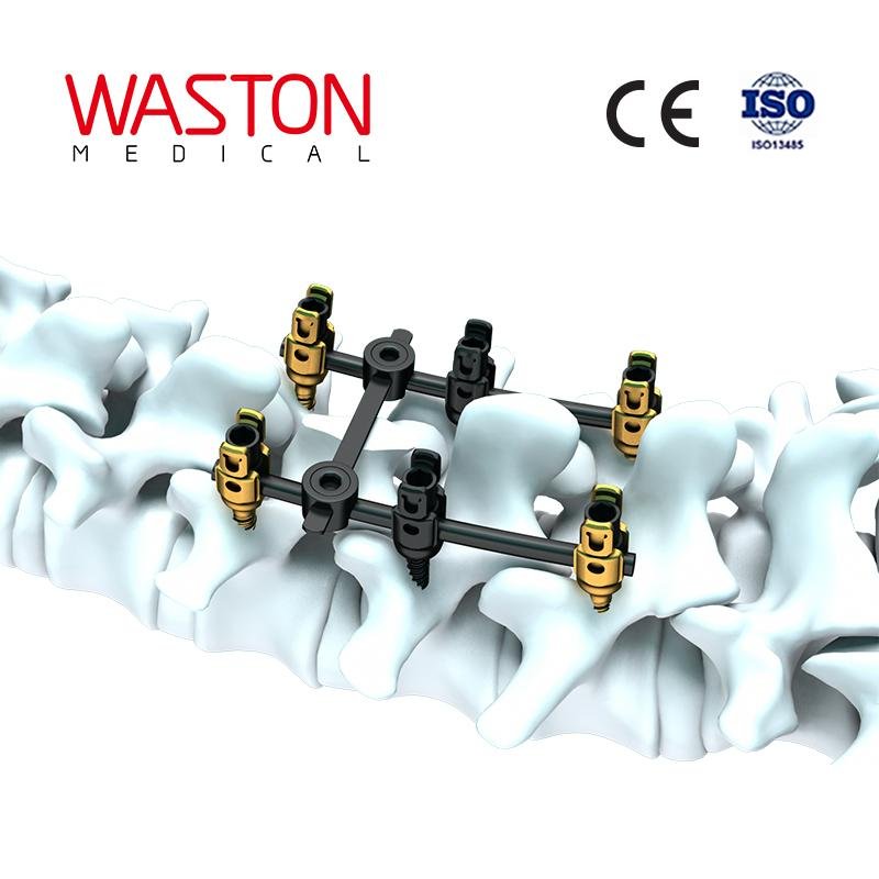 ( Master 7 ) Spinal System--Orthopedic implants, Minimally invasive, Spinal 2
