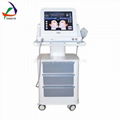 Vacuum processing (medical equipment housing)