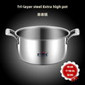 Tri-layer-steel Extra high pot Household 304 Stainless Steel Soup Pot