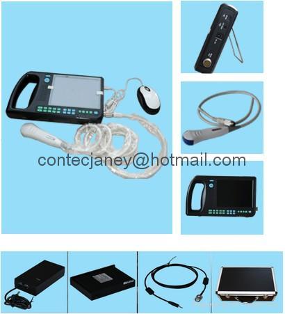 CMS600S 便携式数字超声扫描仪