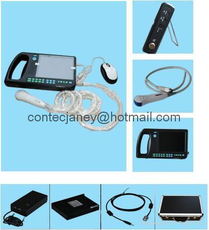 GBP600S Digital PalmSmart Uitrasound Scanner