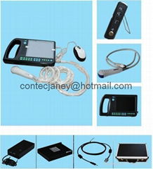 CMS600S 便携式数字超声扫描仪