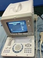 Portable Full Digital Ultrasound Scanner  