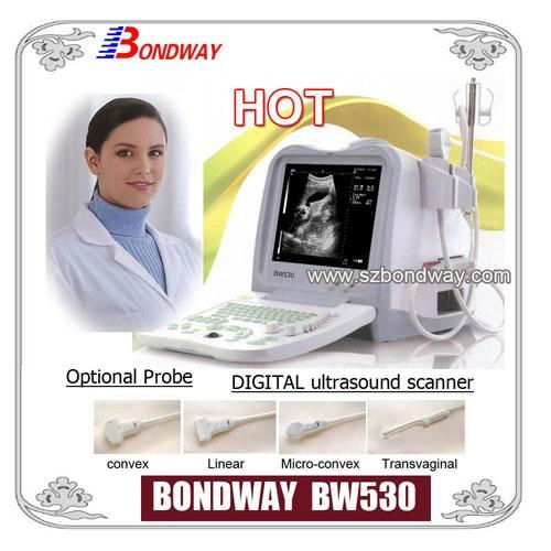 Digital Portable Ultrasound Scanner BW530