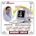 Digital Portable Ultrasound Scanner BW530
