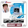 Digital Portable Ultrasound Scanner BW8T