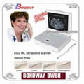 DIGITAL Laptop Ultrasound Scanner BW8H