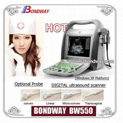 Digital Portable Ultrasound Scanner BW550