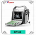 Digital Portable Ultrasound Scanner BW550 2