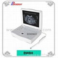 DIGITAL Laptop Ultrasound Scanner BW8H 2