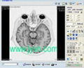 磁共振工作站软件 1