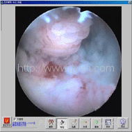 宮腔鏡手朮錄像軟件