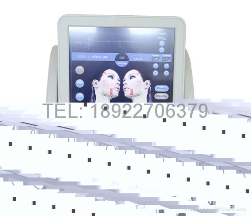 2016 hifu skin lifting beauty ultrasonic knife ultrasound face lift machine