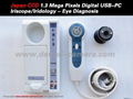 6300U Japan CCD Portable Digital USB Iriscope/Iridology