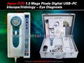 6300U Japan CCD Portable Digital USB Iriscope/Iridology