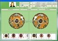 NEW Iridology Pro image Analysis diagnostic Software