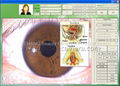 NEW Iridology Pro image Analysis diagnostic Software