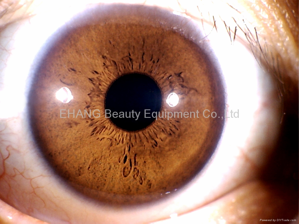 虹膜检测与运用