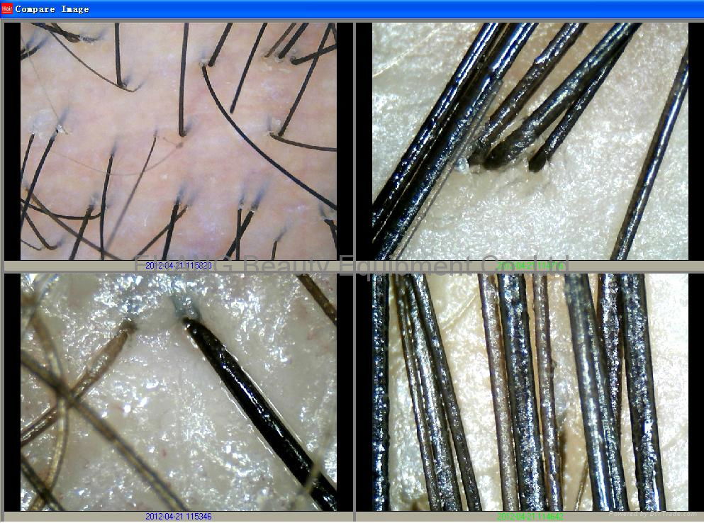 最新8寸高清CCD毛髮檢測儀/頭髮檢測儀/毛囊檢測儀一體機 5